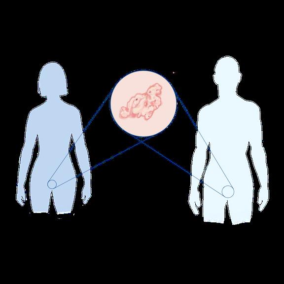 Lichen sclerosis et atrophicans Illustration