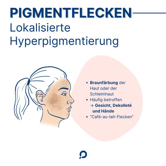 Pigmentflecken Illustration