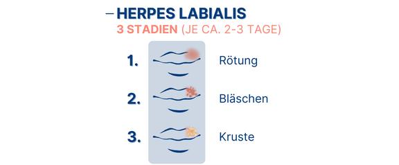 Herpes labialis Stadien