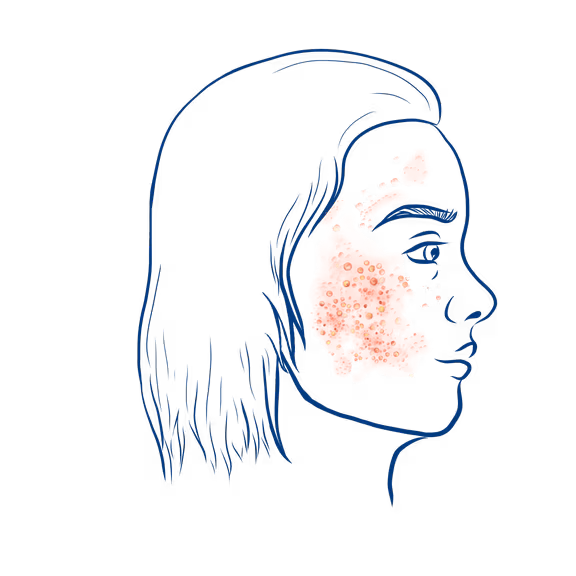 Img