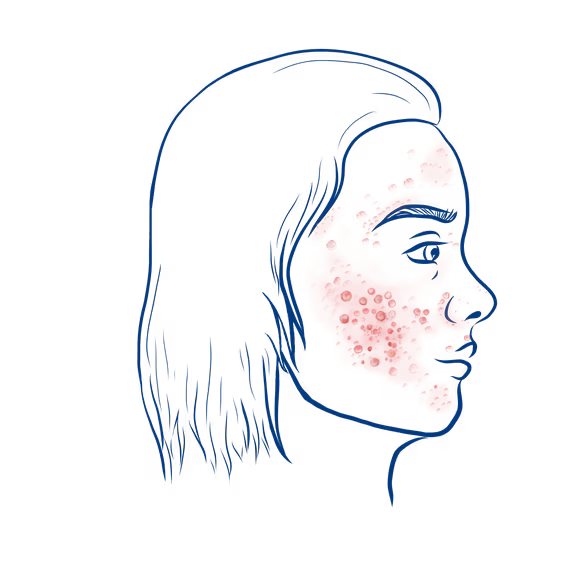Img