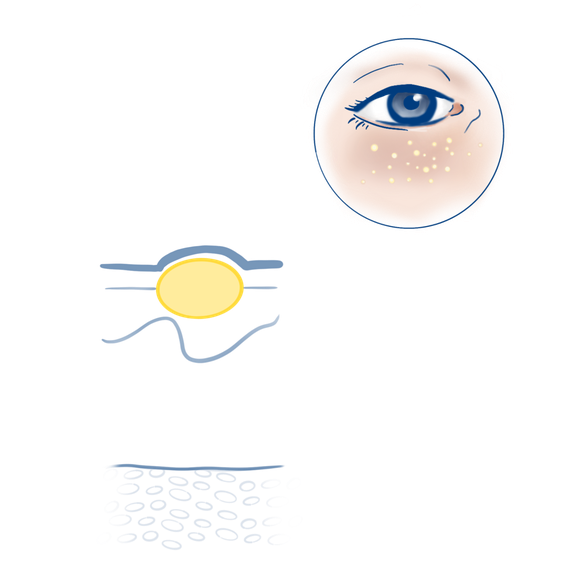 Illustration die Lage und Aufbau von Milien zeigen
